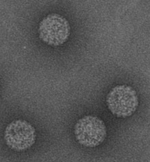 TEM image of MCPyV virus-like particles