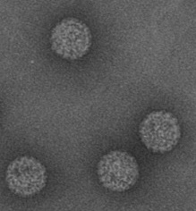 MCPyV TEM image of MCPyV virus-like particles